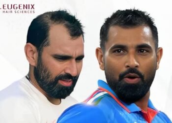 Mohammed Shami incredible hair transformation with Eugenix Hair Sciences