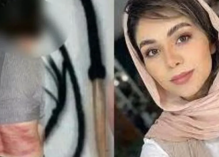 All women in Iran have been required by law to cover their neck and head since shortly after the 1979 Islamic Revolution.